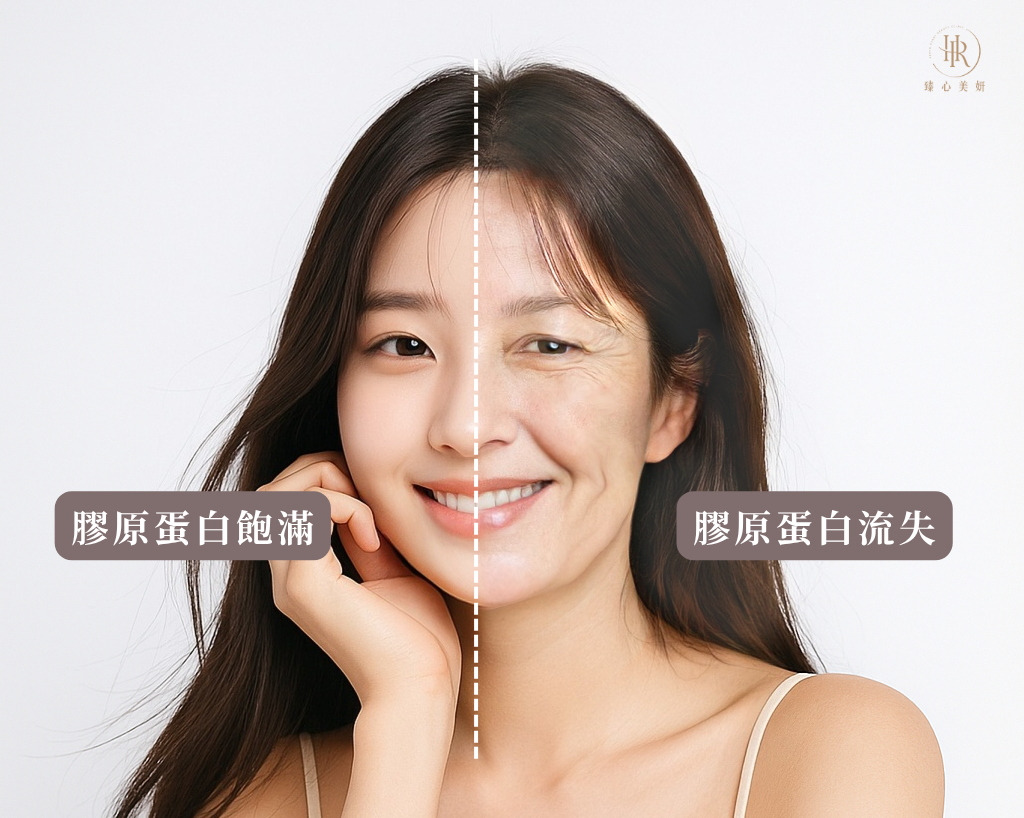 膠原蛋白流失