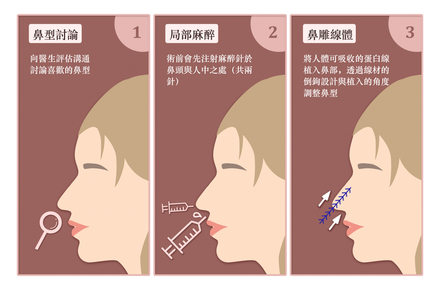 鼻雕做法示意圖