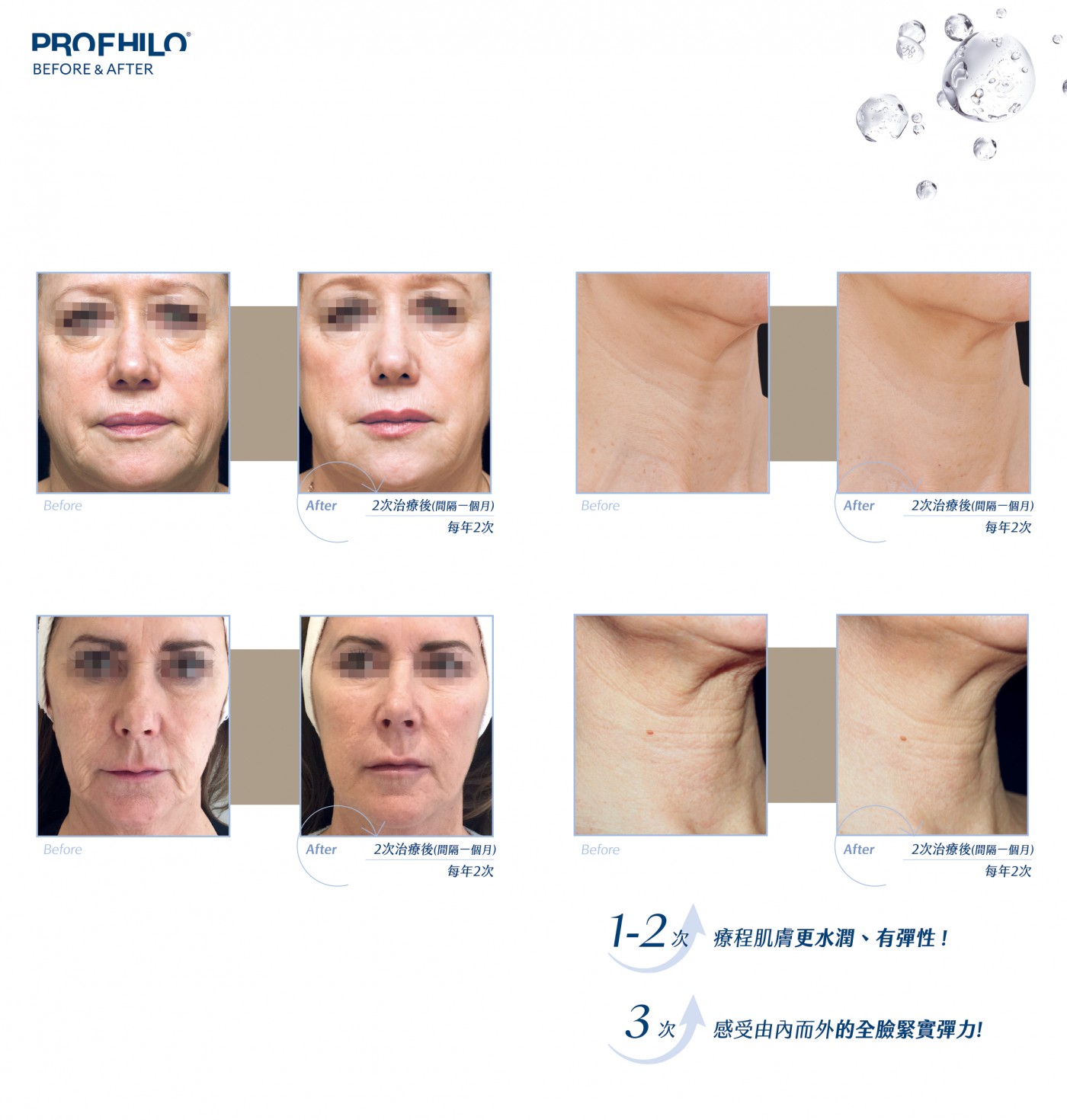 逆時針原廠BA照