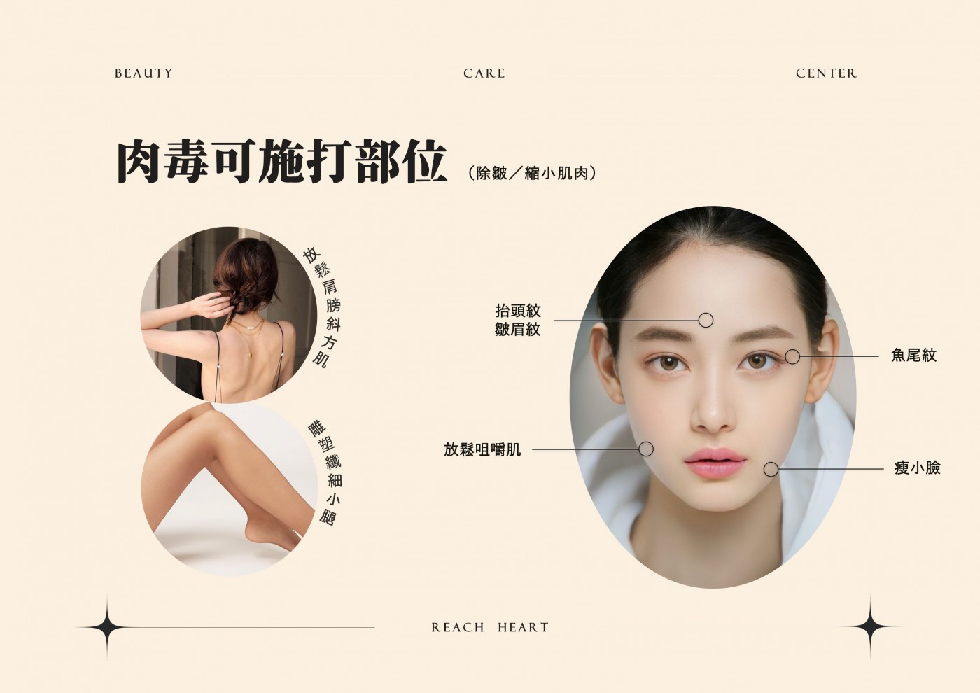 肉毒可施打部位