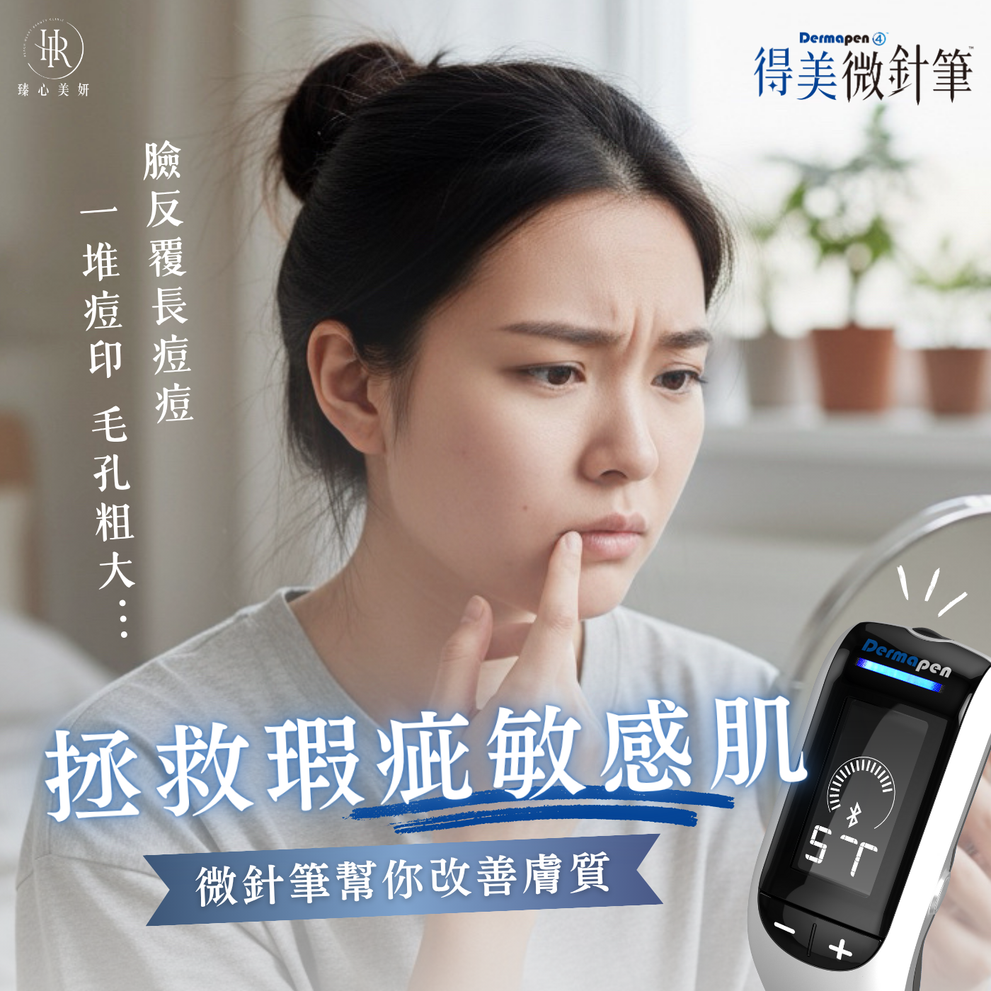 拯救敏感瑕疵肌